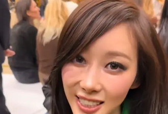 顶流爱豆，怎么集体瘦成皮包骨了？