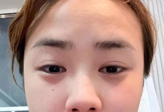 千万网红董赤赤断更5个月后，再出现时面相大变