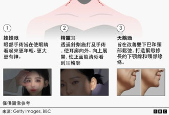 总裁脸、天鹅颈…台湾人为何到上海“跨境医美”?