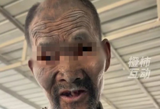 “死了就埋了”!残障老人被奴役20年 老板被刑拘!