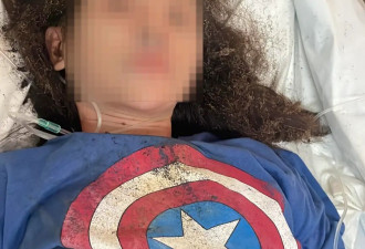 “女主播遭快递盒爆炸烧伤案”更多细节曝光
