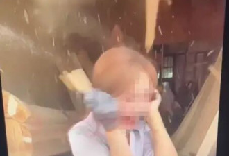 “女主播遭快递盒爆炸烧伤案”更多细节曝光