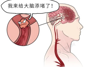 你爱用的这种枕头 正悄悄堵住脑血管