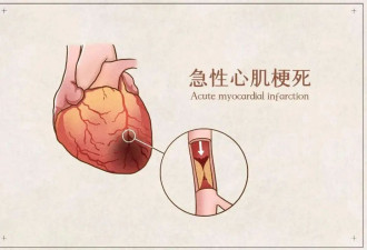 心脏“罢工”前 会发出哪些警告？
