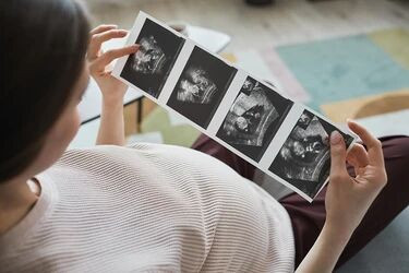 A pregnant woman holding ultrasound images of a fetus. Photo by Adobe Stock