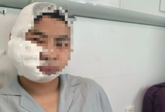 男子在长沙海洋王国水下项目游玩遭3米长鲨鱼咬伤