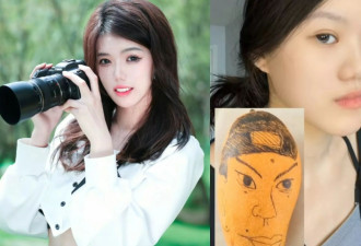24岁女子做正颌手术后 自嘲“像朱元璋” 医生：比术前更洋气