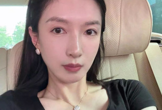 江疏影出席活动，表情失控露三层下巴