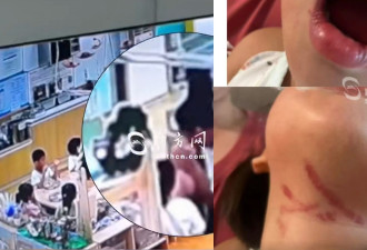 中山3岁童遭幼儿园老师暴力喂食 涉事老师被拘留
