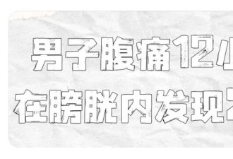 “痛”！男子往尿道塞入25cm长数据线,硬撑12小时