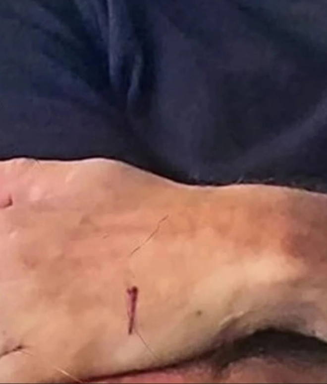 Jordan Sangwin cut hand