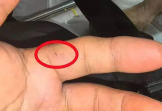 58岁男子徒手抓蛇,被咬后还和蛇淡定合影,结果...