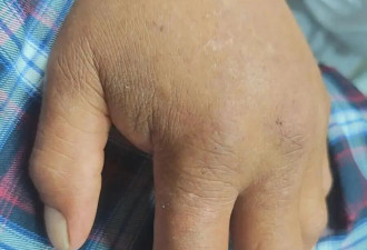 58岁男子徒手抓蛇,被咬后还和蛇淡定合影,结果...