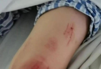 河北女子遭家暴驾车逃跑致丈夫身亡案二审维持原判