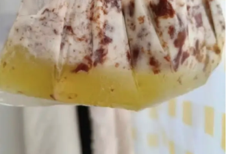 好可怕！夏季很多人爱吃它解暑 其实是在喝油…