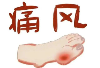 痛风为啥盯上你？年轻人5个习惯易患病