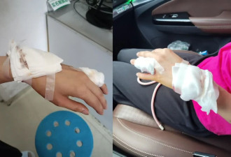 女子称大窑玻璃瓶静置时爆裂，“两根手筋断了”