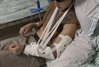 被游客掰断手腕的景区NPC系一级运动员,本人发声