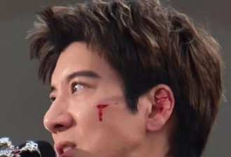 王力宏成都演唱会发生意外！脸部受伤流血