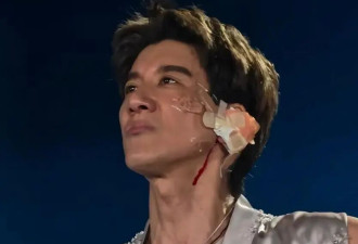王力宏治疗摔伤细节曝光,去的医美科找的顶级专家