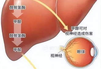 死亡率近100%，国内暂无解药，50毫升就可致死