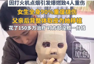 男子拧开煤气试图迷晕少女性侵 ，因点烟引发爆燃