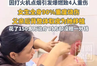 男子拧开煤气试图迷晕少女性侵 ，因点烟引发爆燃