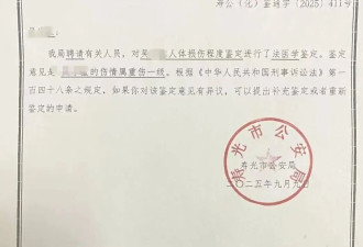 男子拧开煤气试图迷晕少女性侵 ，因点烟引发爆燃
