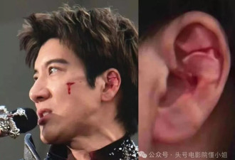 王力宏缝39针!陈奕迅曾撞伤下体,演唱会事故太邪门