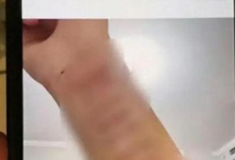 注射不明物不算啥！关晓彤不再隐忍 鹿哥被曝“仙人跳”，真相将明