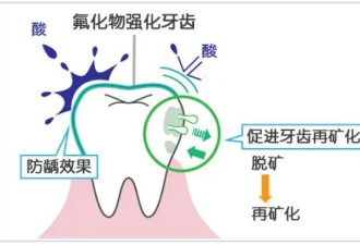 刷牙“偷懒”省了这步骤 反而更防蛀？