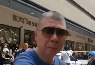 冯小刚这下老实了 坐头等舱脑袋全是斑块