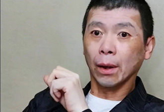 冯小刚这下老实了 坐头等舱脑袋全是斑块