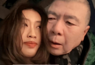 冯小刚这下老实了 坐头等舱脑袋全是斑块