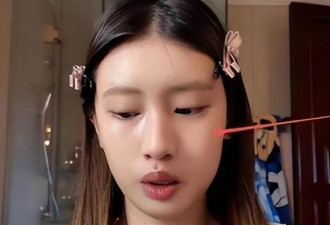 冯小刚终被曝脑袋全是斑块,养女徐朵脸肿原因藏不住了