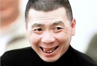 冯小刚终被曝脑袋全是斑块,养女徐朵脸肿原因藏不住了