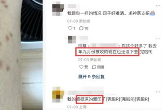 身上出现这种包 千万别挠! 比蚊子还毒啊