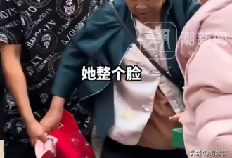岳云鹏自曝母亲患尿毒症 每天透析、又患疱疹