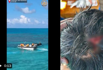 中国海警棍棒猛击菲国水兵头部 马尼拉曝受伤照