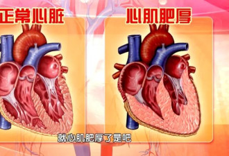 这种运动伤心、毁脑 别再跟风踩坑了