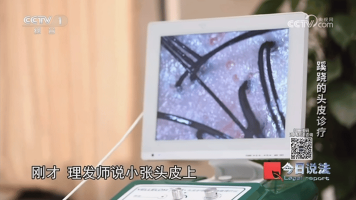 洗个头花2万！宁波警方破获特大美发诈骗案