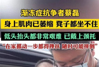 蔡磊现状令人泪目，舌头嘴唇已经萎缩，洗澡用绳子吊