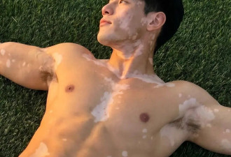 爆火的白癜风男模Russel，到底是真人励志偶像，还是AI捏出来的流量密码？