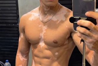 爆火的白癜风男模Russel，到底是真人励志偶像，还是AI捏出来的流量密码？