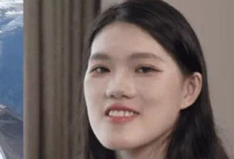 女孩称做正颌手术反成"鞋拔子脸",医生表示自己喜欢